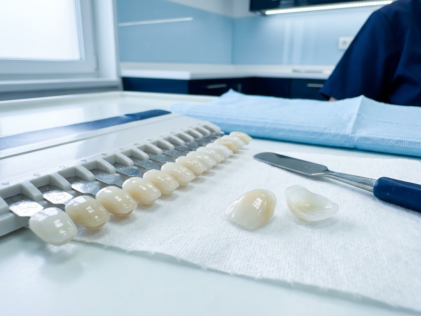 Detalhe clínico do tratamento: Facetas de resina